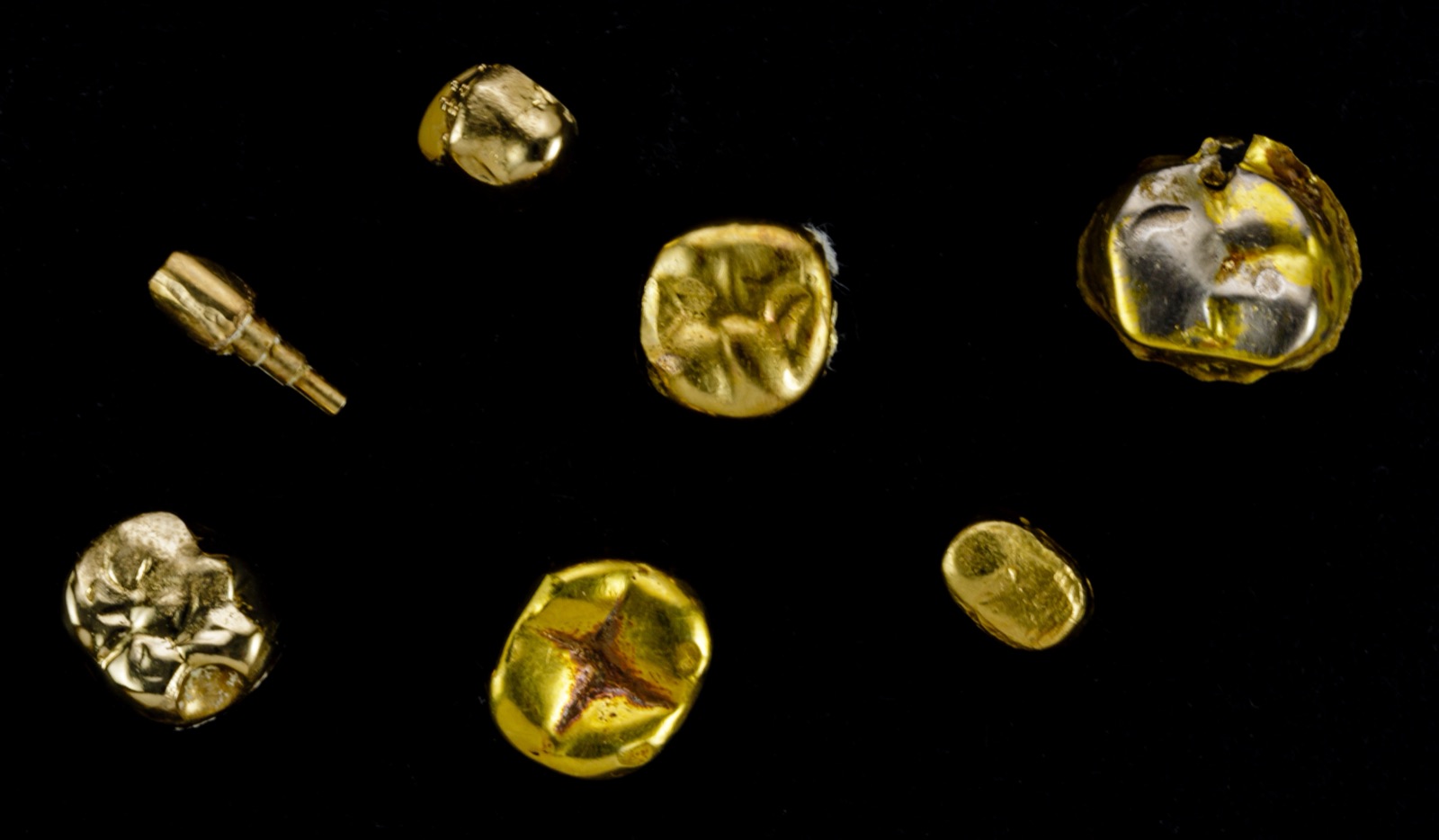 Photographie : lot d’or dentaire sur fond noir, couronnes, inlays et tenon en or